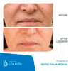 CFU-ELIFE_Before-After_04