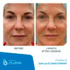 CFU-ELIFE_Before-After_11