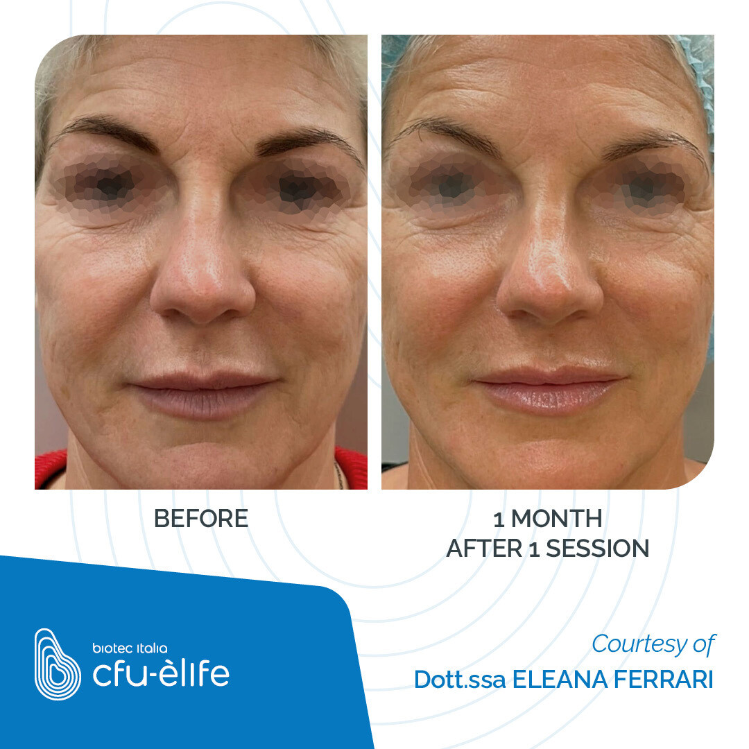 CFU-ELIFE_Before-After_11